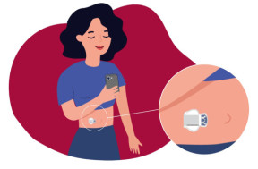 Непрерывный мониторинг глюкозы — новый метод самоконтроля для больных сахарным диабетом